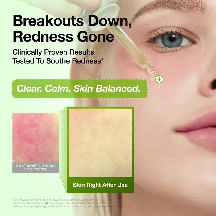 Dropper applying Anua Azelaic Acid Serum to cheek next to an inset photo showing immediate reduction in skin redness
