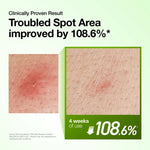 Magnified skin texture comparison demonstrating 108.6% improvement in troubled spot area after 4 weeks of serum use