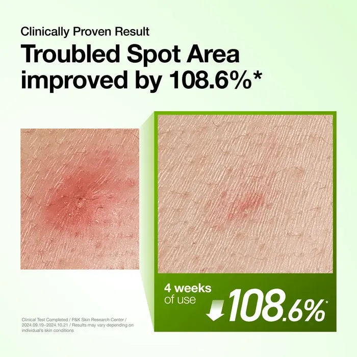 Magnified skin texture comparison demonstrating 108.6% improvement in troubled spot area after 4 weeks of serum use