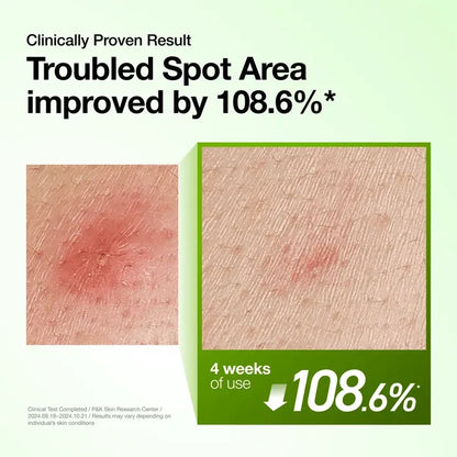 Magnified skin texture comparison demonstrating 108.6% improvement in troubled spot area after 4 weeks of serum use