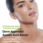 Close-up Kendell Jenner portrait featuring dermatologist-approved Anua Azelaic Acid Serum for breakout-prone skin and redness