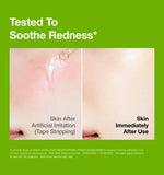 Before and after skin comparison showing immediate soothing of tape stripping irritation with Anua Azelaic Acid Serum