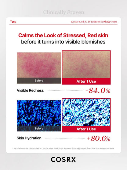 Azelaic Acid 20 B5 Redness Soothing Cream 30ml