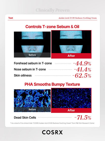 Azelaic Acid 20 B5 Redness Soothing Cream 30ml