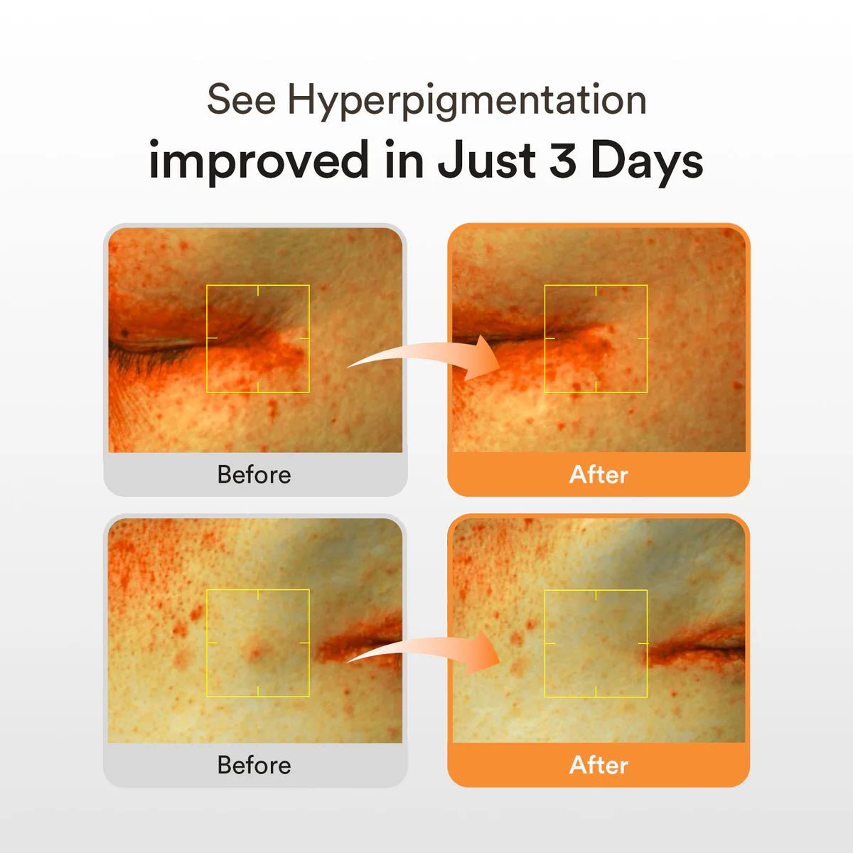 Buy Abib Glutathiosome Dark Spot serum Vita Drop 50ml Online in Saudi Arabia - YASHIE SA