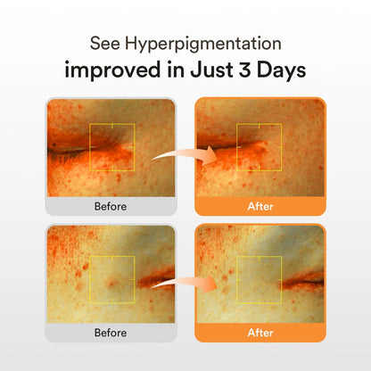 Buy Abib Glutathiosome Dark Spot serum Vita Drop 50ml Online in Saudi Arabia - YASHIE SA