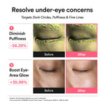 Before and after effects of an pdrn eye patch product targeting under-eye concerns on a white background.