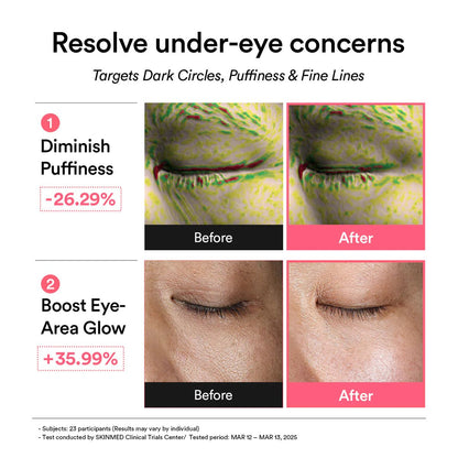 Before and after effects of an pdrn eye patch product targeting under-eye concerns on a white background.