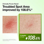 Magnified skin texture comparison demonstrating 108.6% improvement in troubled spot area after 4 weeks of serum use