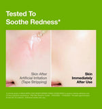 Before and after skin comparison showing immediate soothing of tape stripping irritation with Anua Azelaic Acid Serum