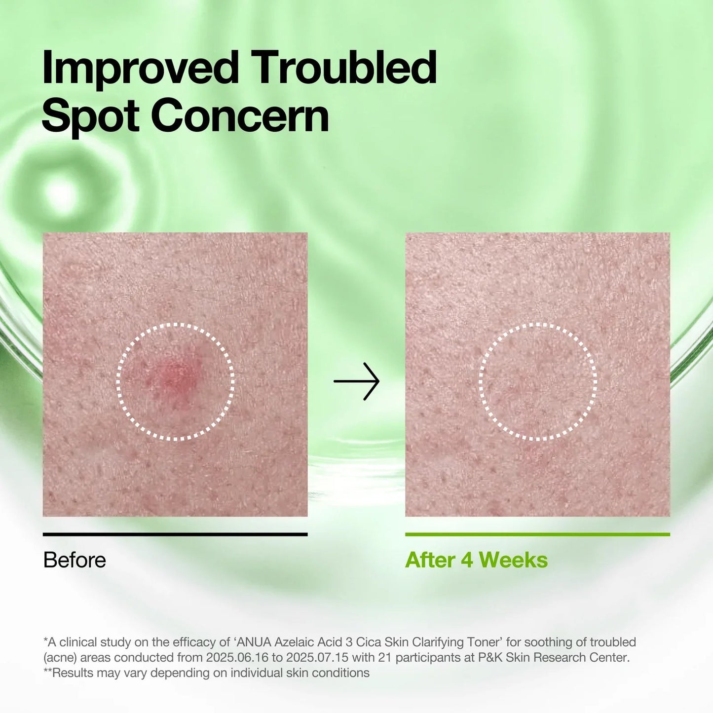 Buy Anua Azelaic Acid 3 Cica Skin Clarifying Toner 250ml Online in Saudi Arabia - YASHIE SA