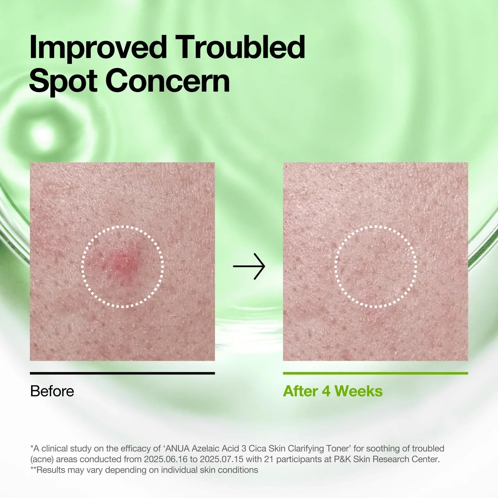 Buy Anua Azelaic Acid 3 Cica Skin Clarifying Toner 250ml Online in Saudi Arabia - YASHIE SA