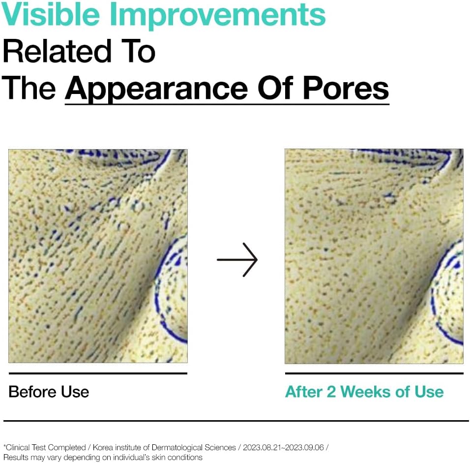 Buy Anua BHA 2% Gentle Exfoliating Toner 150ml Online in Saudi Arabia - YASHIE SA