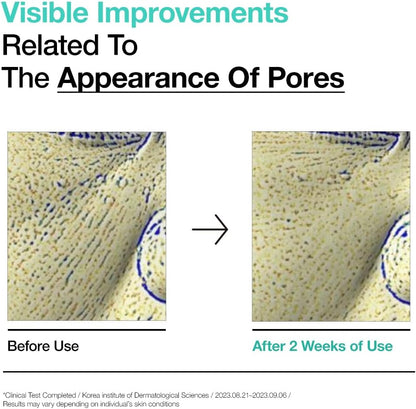 Buy Anua BHA 2% Gentle Exfoliating Toner 150ml Online in Saudi Arabia - YASHIE SA