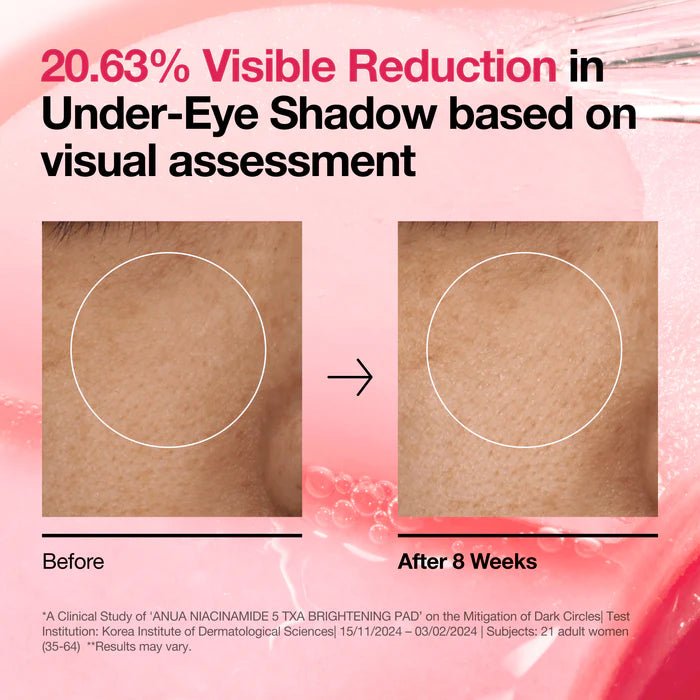 Buy Anua Niacinamide 5 TXA Brightening Pad 180ml Online in Saudi Arabia - YASHIE SA
