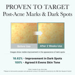 Before and after comparison showing 18.62% improvement in dark spots and more even skin tone after 2 weeks.