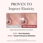 Before and after comparison showing improved pore elasticity and a 14.4% increase in facial firmness over two weeks.