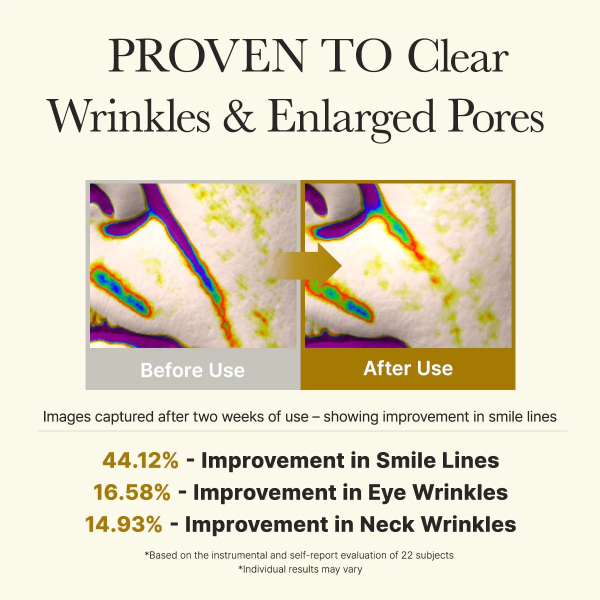 Before & after skin scans showing over 44% improvement in smile lines and reduced wrinkles after 2 weeks