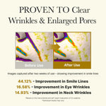Before & after skin scans showing over 44% improvement in smile lines and reduced wrinkles after 2 weeks