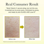 Real results: Arencia Vitamin C Booster visibly reduces acne scars, pores & uneven texture for smoother, radiant skin.