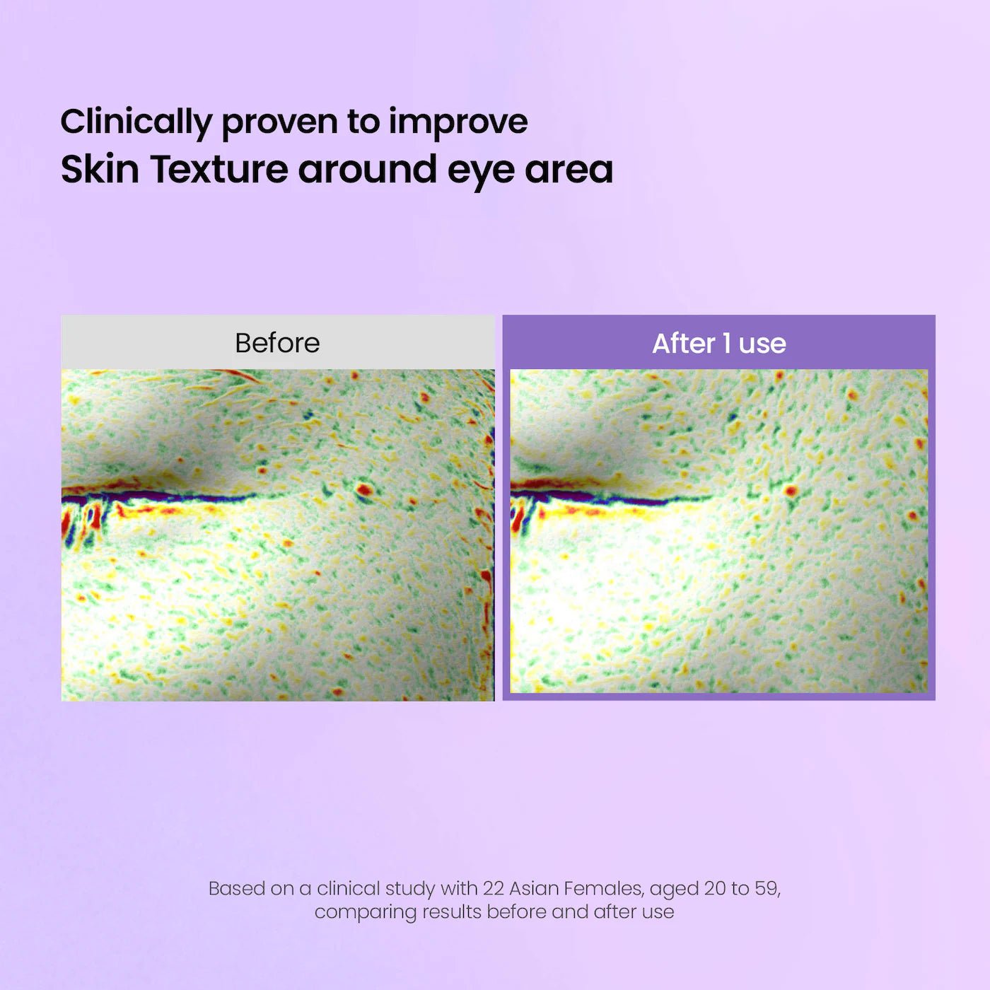 Before and after scan showing improved skin texture around the eye area after one use of Biodance patches.