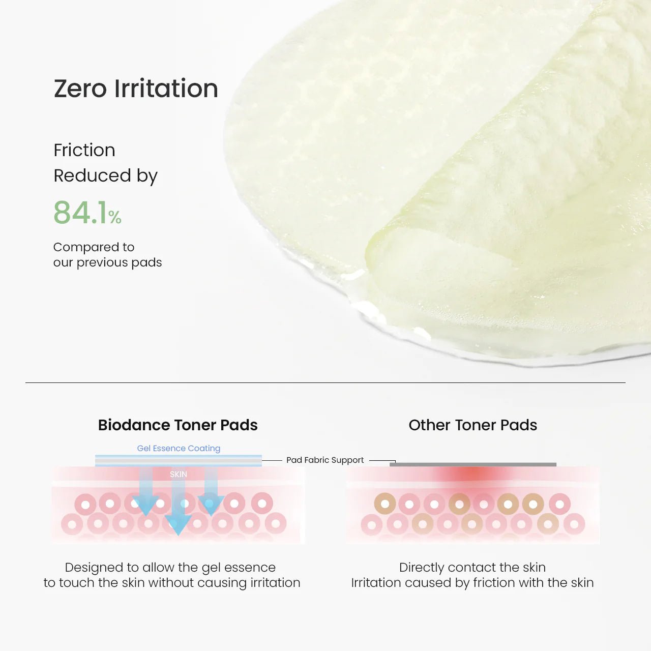 Clinical results showing decreased blackheads, whiteheads, and sebum production.