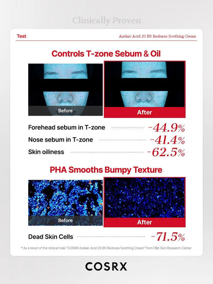 Buy Cosrx Azelaic Acid 20 B5 Redness Soothing Cream 30ml Online in Saudi Arabia - YASHIE SA