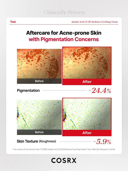 Buy Cosrx Azelaic Acid 20 B5 Redness Soothing Cream 30ml Online in Saudi Arabia - YASHIE SA