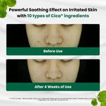 Before and after 4-week results showing reduced skin redness using Dr.G Red Blemish Clear Soothing Cream.