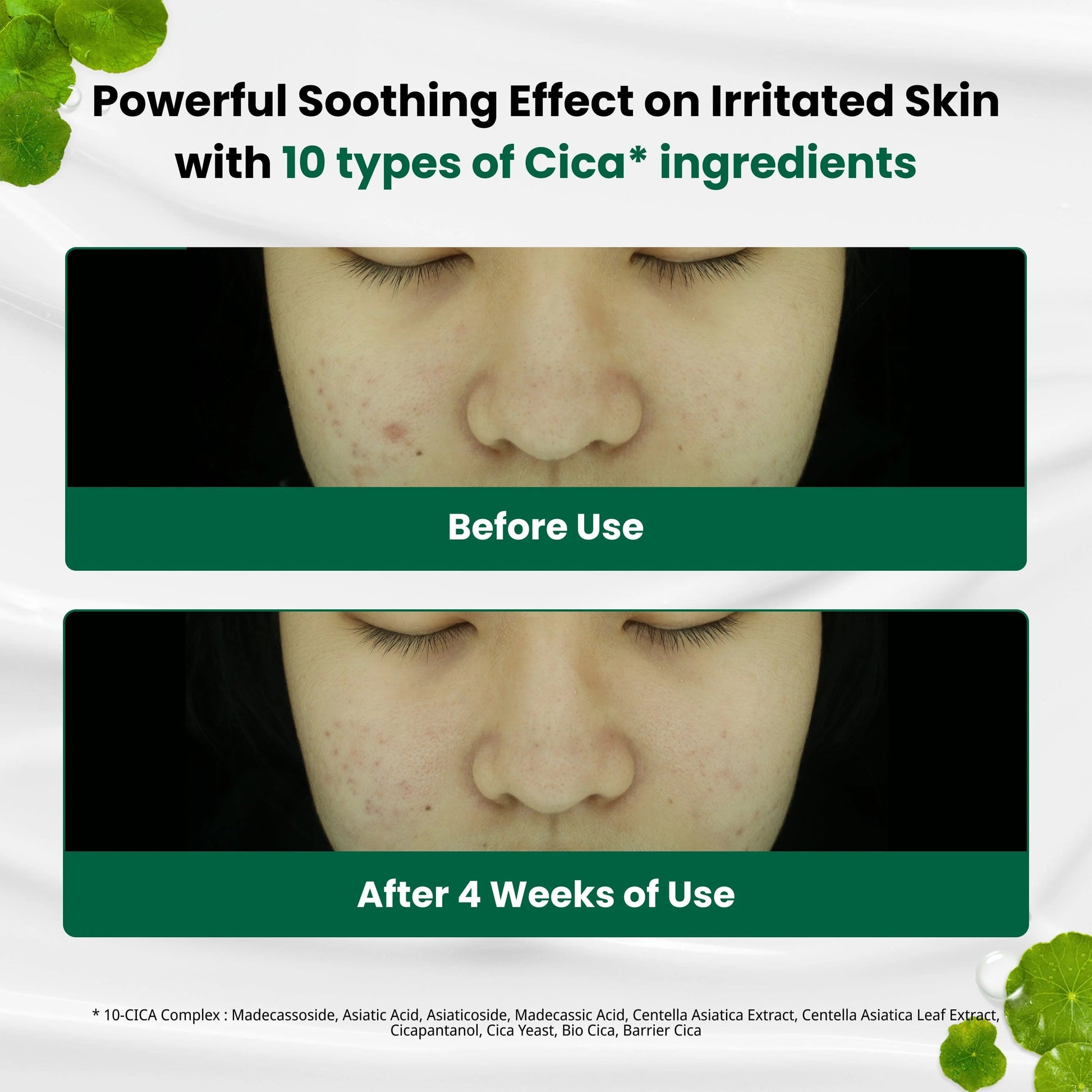 Buy Dr G Red Blemish Clear Soothing Cream 70ml Online in Saudi Arabia - YASHIE SA