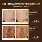 Clinical before and after photos showing a 14% improvement in surface melanin and 10% in deep layer melanin.