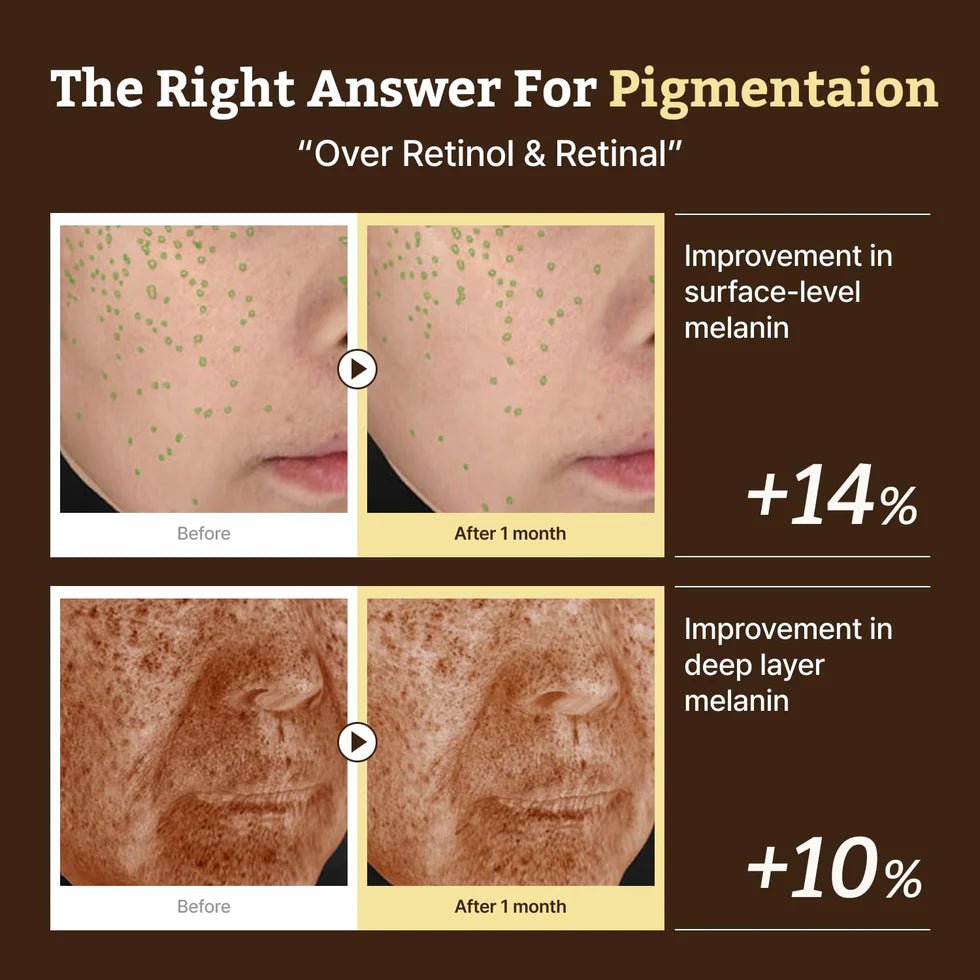 Clinical before and after photos showing a 14% improvement in surface melanin and 10% in deep layer melanin.