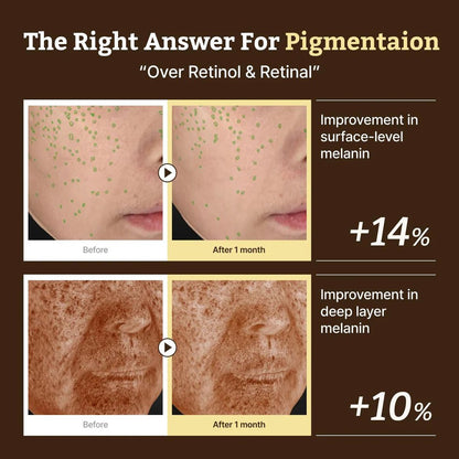 Clinical before and after photos showing a 14% improvement in surface melanin and 10% in deep layer melanin.
