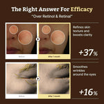 Comparison photos showing 37% better skin clarity and a 16% reduction in eye wrinkles after one month of use.