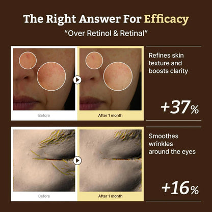 Comparison photos showing 37% better skin clarity and a 16% reduction in eye wrinkles after one month of use.