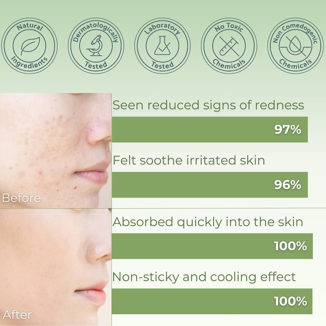 Buy iUNIK Centella Calming Gel Cream 60ml Online in Saudi Arabia - YASHIE SA