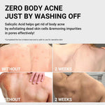 Buy Medicube Medicube Red Glow Acne Care Body Bundle Online in Saudi Arabia - YASHIE SA