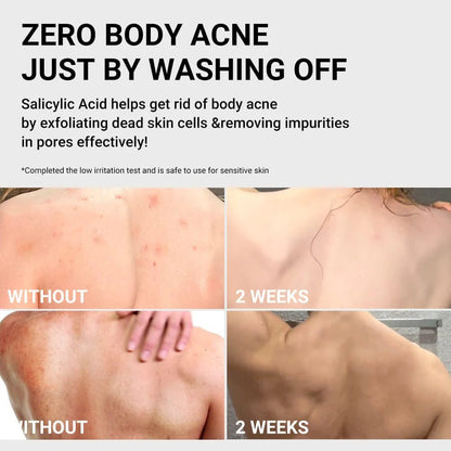 Buy Medicube Medicube Red Glow Acne Care Body Bundle Online in Saudi Arabia - YASHIE SA