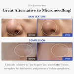 Before and after results for skin texture and complexion showing a smoother, brighter face.