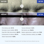 Infographic showing 21% pore visibility reduction and 88% dead skin cell improvement results.