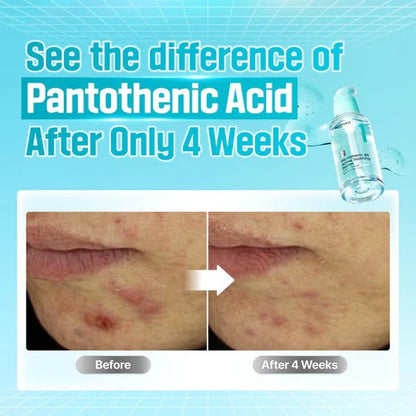 Buy Numbuzin No.1 Pantothenic B5 Active Soothing Serum 50ml Online in Saudi Arabia - YASHIE SA