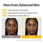 Before and after photos of a woman showing more even and balanced skin tone after use.