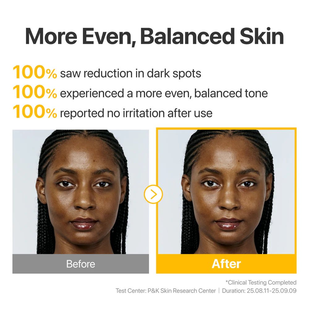 Before and after photos of a woman showing more even and balanced skin tone after use.