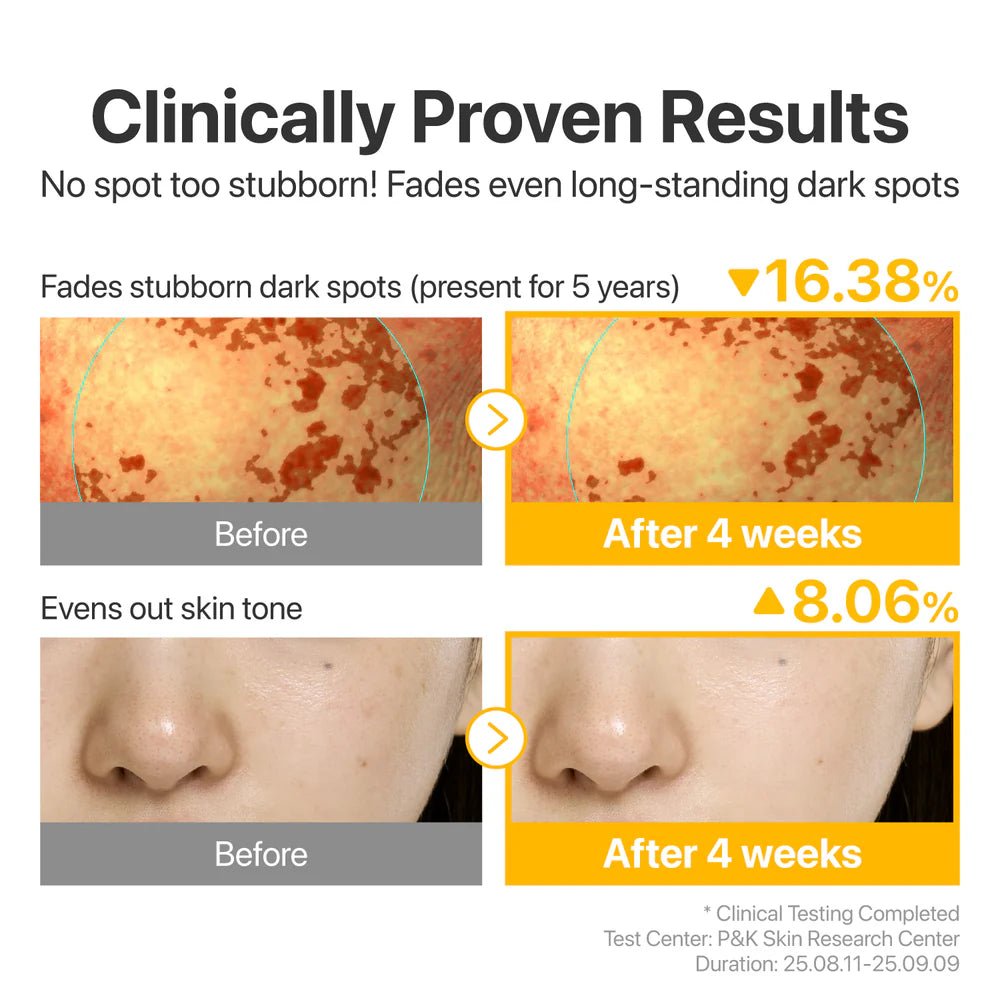 Clinical results showing 16.38% reduction in stubborn dark spots and 8.06% more even skin tone.