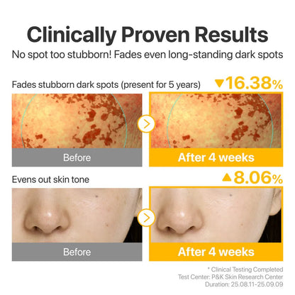 Clinical results showing 16.38% reduction in stubborn dark spots and 8.06% more even skin tone.