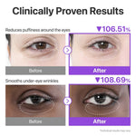 Before and after comparison showing 106% reduced puffiness and 108% smoother eye wrinkles.