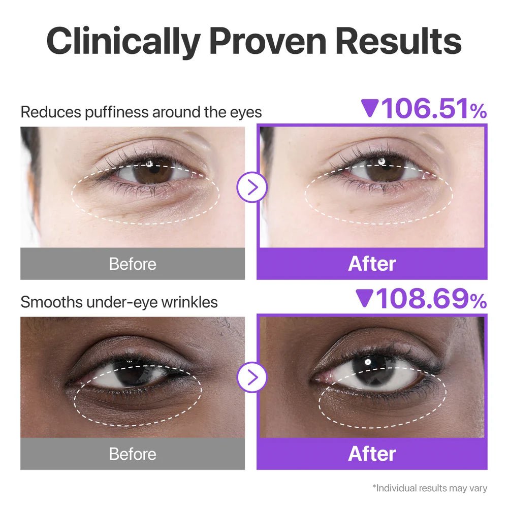 Before and after comparison showing 106% reduced puffiness and 108% smoother eye wrinkles.