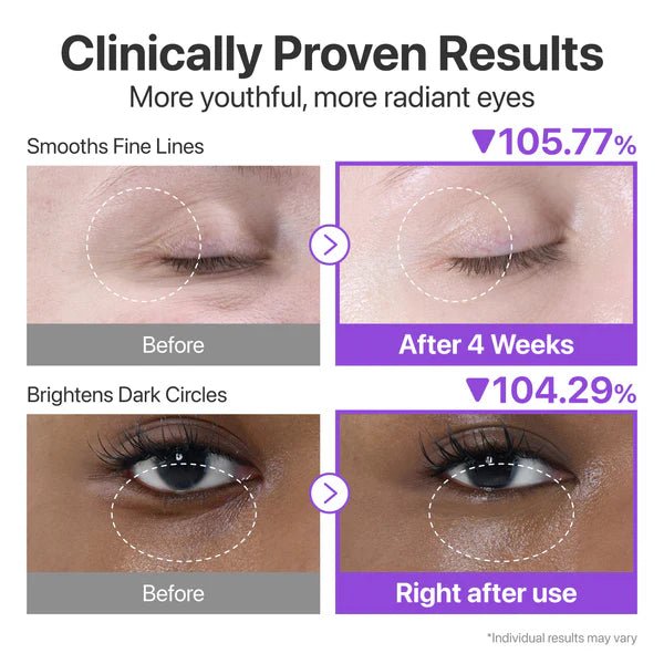 Buy Numbuzin No.9 NAD Retinol Volumetox Eye Cream 10ml Online in Saudi Arabia - YASHIE SA