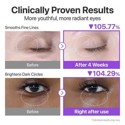 Buy Numbuzin No.9 NAD Retinol Volumetox Eye Cream 10ml Online in Saudi Arabia - YASHIE SA