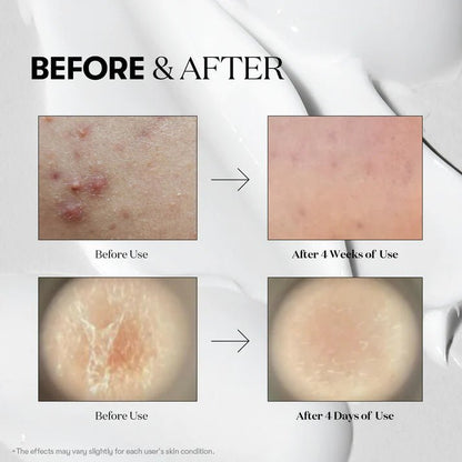 Buy VT Cosmetics Reedle Shot 300 50ml Online in Saudi Arabia - YASHIE SA